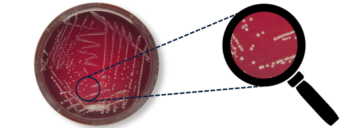 Peptostreptococcus anaerobius