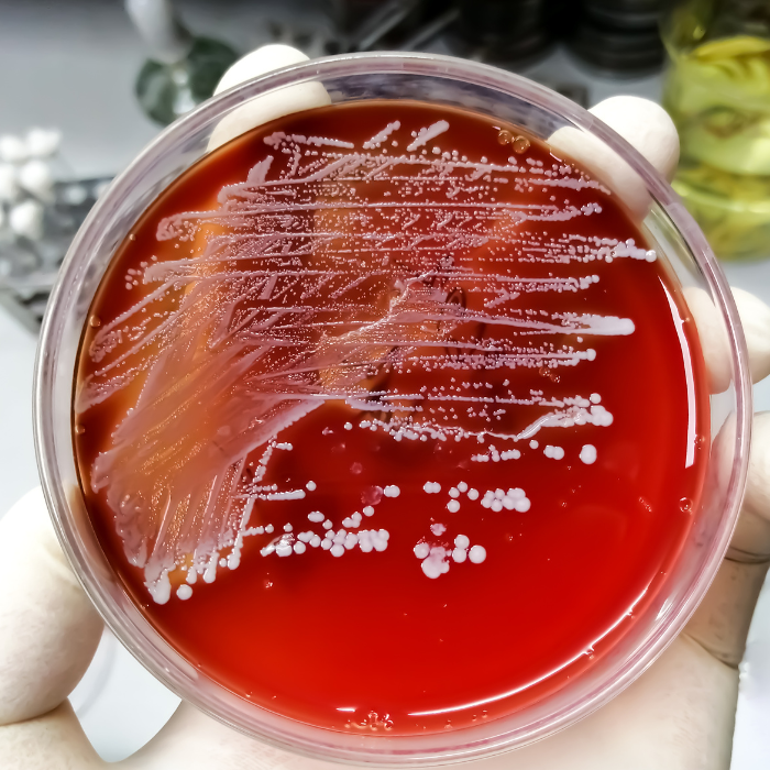 Staphylococcus aureus
