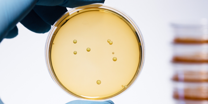 Lactobacillus bacteria colonies.