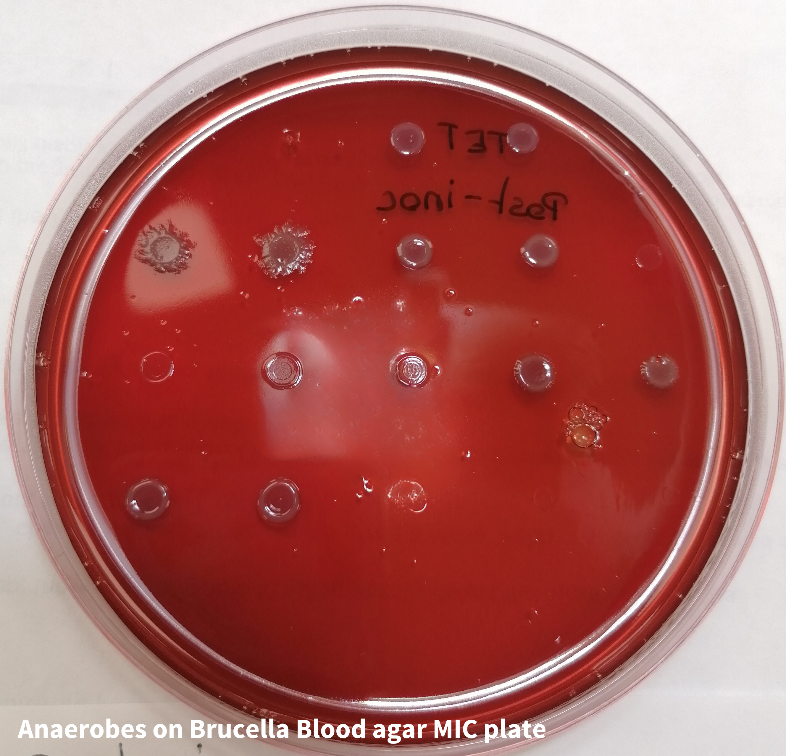 Minimal Inhibitory Concentration (MIC) testing and Minimal Bactericidal Concentration (MBC) testing