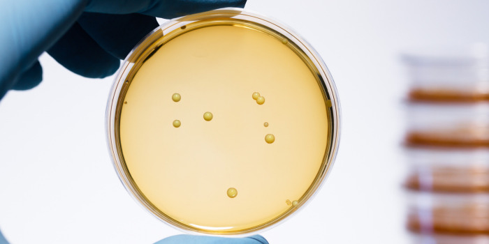 Lactobacillus bacteria colonies.