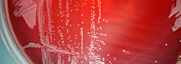 Campylobacter 