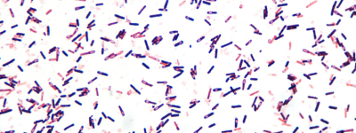 Clostridium Difficile