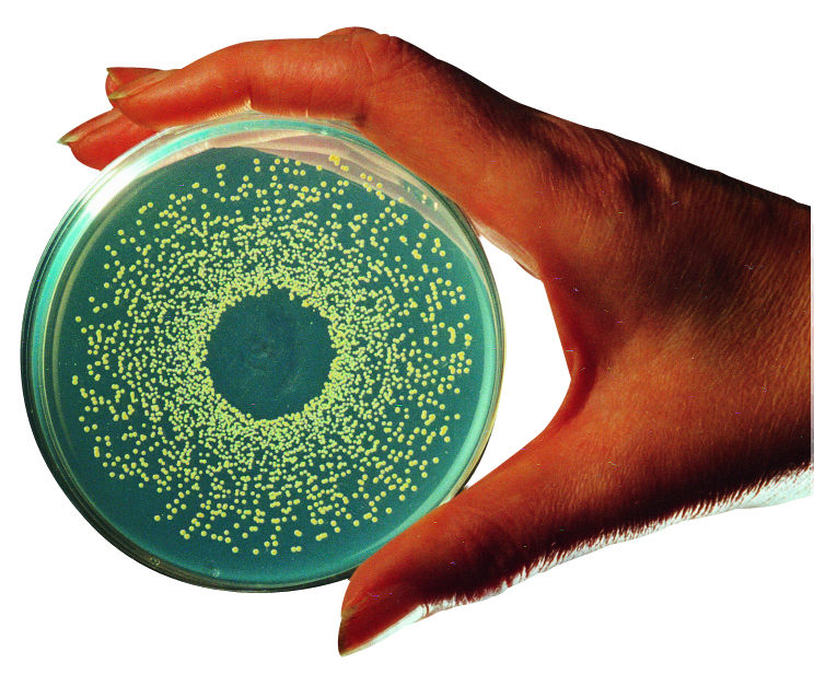 Petri dish image