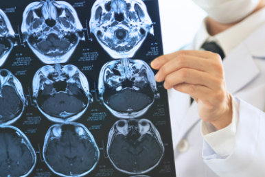 Doctor holding up brain scan