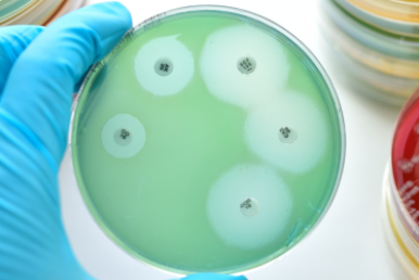 Antimicrobial Susceptibility Testing