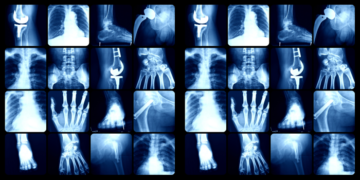 x-rays