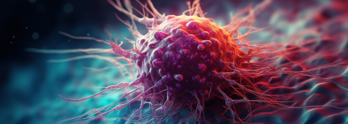 AI Image of caner cell in breast tissue