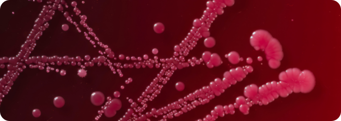 DWS Travel Grant Awardee Presents Clostridioides difficile Research in Belfast