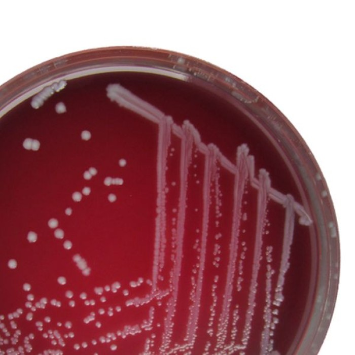 DYK7: Anaerobic Control Strains