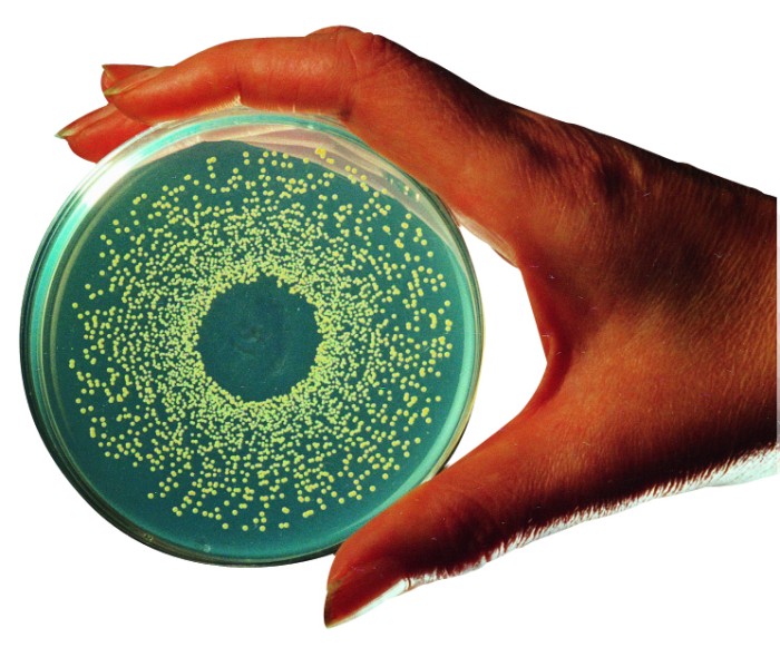 Spiral Plate