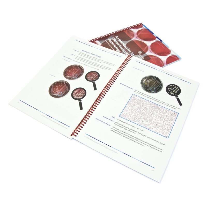 Introduction to Clinical Anaerobic Bacteriology