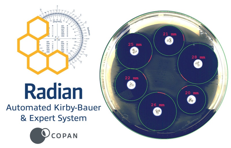 Radian®